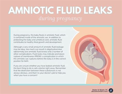 amniotic fluid sticky|Leaking Amniotic Fluid: Signs, Causes, and。